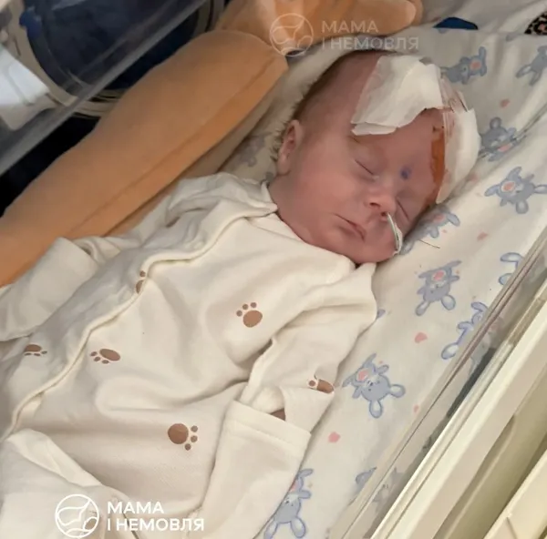 Гідроцефалія загрожує життю Андрійчика. Терміново потрібна допомога